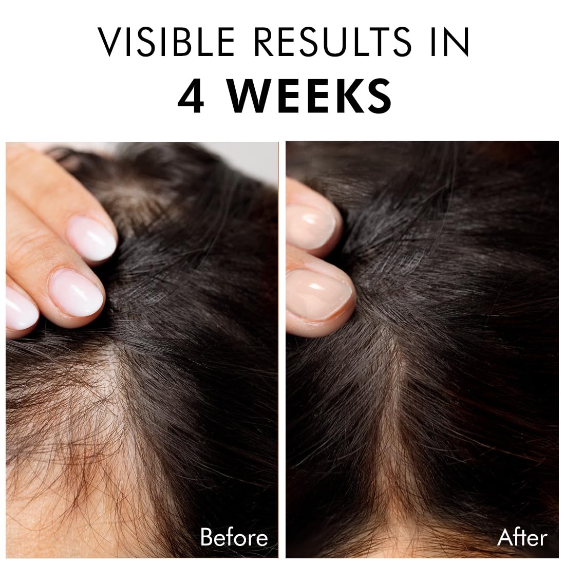 Before and after comparison of hair growth with visible results in 4 weeks text.