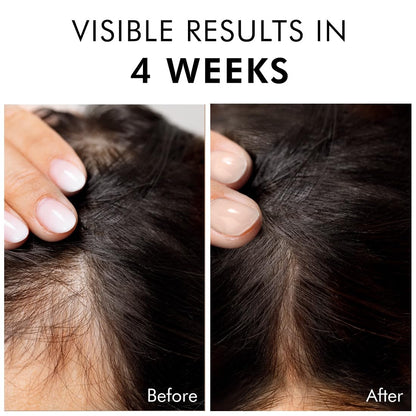 Before and after comparison of hair growth with visible results in 4 weeks text.