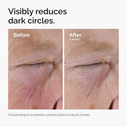 Before and after comparison of dark circles under eyes with text indicating reduction over 6 weeks.