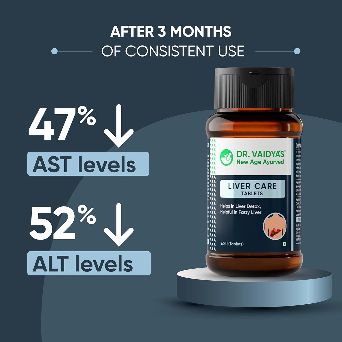 Dr. Vaidya Liver Care Tablets | Ayurvedic Fatty Liver Support, Detox & Cleanse | Improves Liver Health, Digestion & Metabolism | Herbal Supplement with Ayurvedic Herbs | 60 Tablets