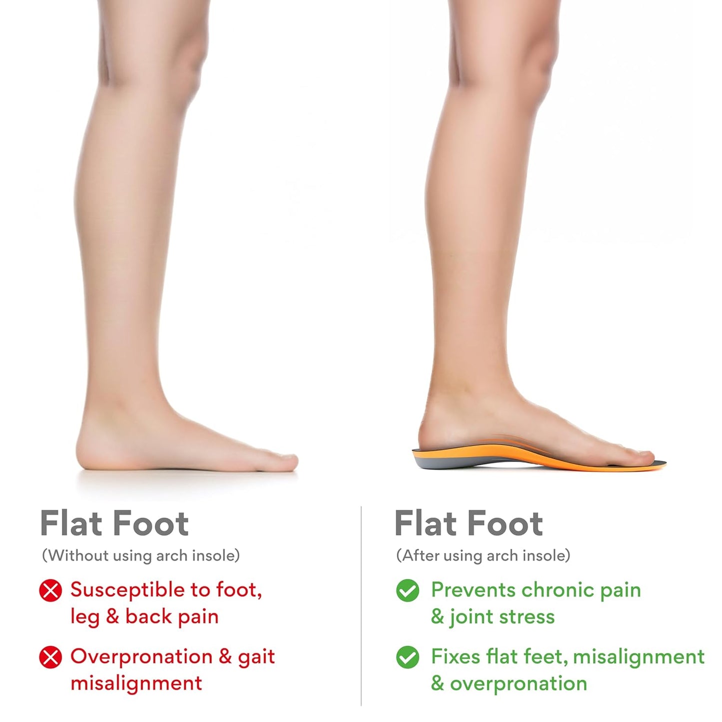 FOVERA Rigid Arch Support Insole for Flat Feet - Orthotic Shoe Inserts for Plantar Fasciitis, Heel Spurs, High Arch, Foot Pain & Enhanced Stability, Trimmable Shoe Soles (L, Men's 8-9.5 UK)
