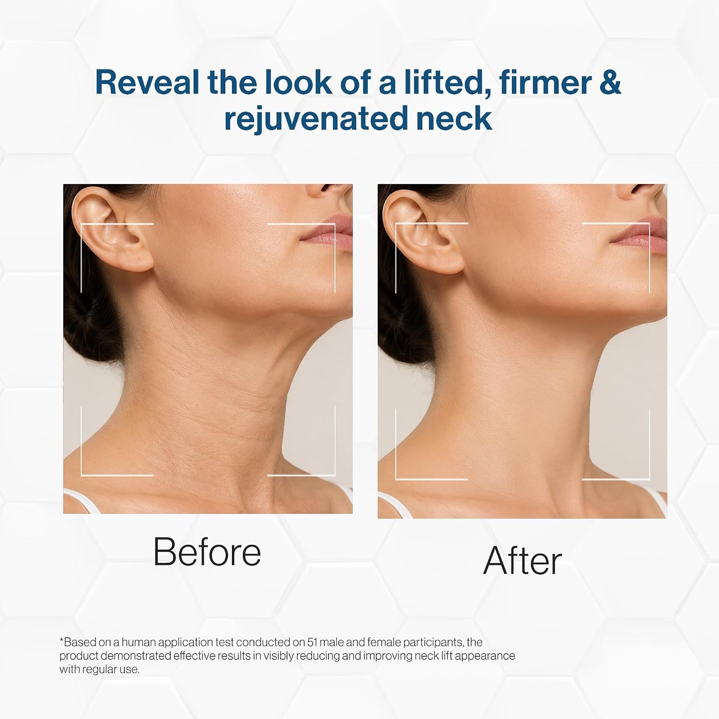 FCL Retinol Neck Firming Complex | Neck Cream for Fine Lines and Wrinkle - 50g