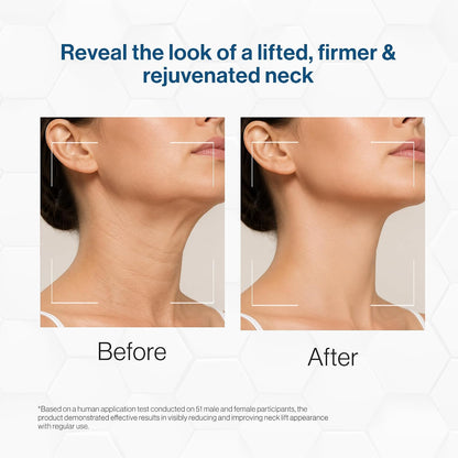 FCL Retinol Neck Firming Complex | Neck Cream for Fine Lines and Wrinkle - 50g