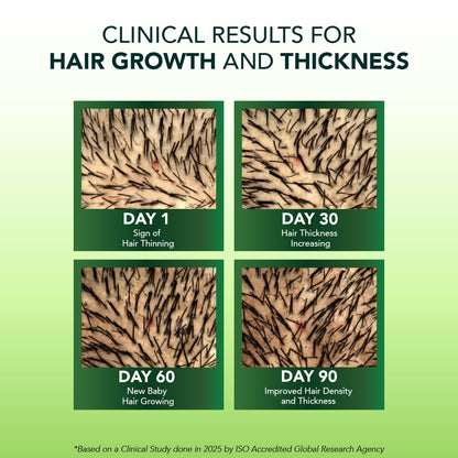 Alps Goodness Rosemary Water Spray for Hair Growth (250ml) | Clinically Proven (In Vivo Tested) to Reduce Hair Fall & Promote Regrowth | 100% Natural Rosemary Extract | Leave-On Scalp & Hair Spray For Men & Women