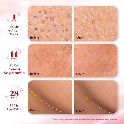 Before and after skin treatment results showing visibly reduced pores, deep wrinkles, and lifted skin.