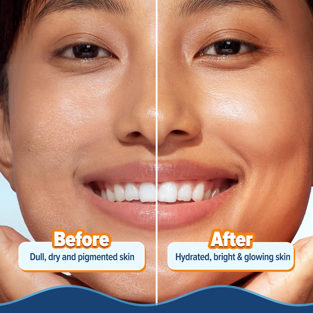Aqualogica Glow+ Hydra Gel Moisturizer with Vitamin C & Papaya | 24-Hour Intense Hydration | Weightless Water-Like Gel Texture | Non Sticky & Quick Absorbing for Glowing Skin | 200 g