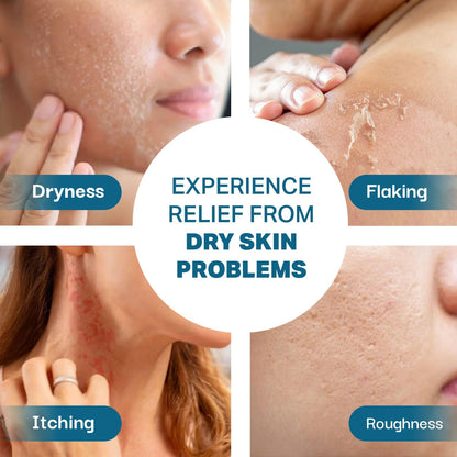 Intensive Moisturizing Cream| For Sensitive Dry to Normal Skin| Pack Of 1X100ml