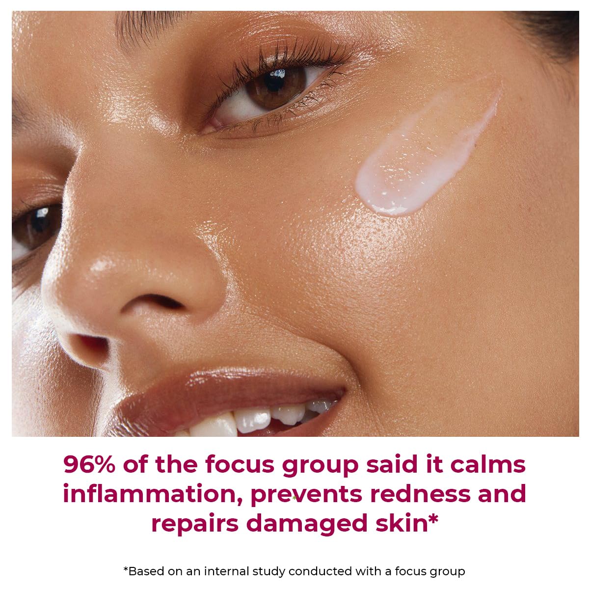 Conscious Chemist® 10% Azelaic Acid Cream | 50g | Face Cream for Men & Women, Moisturizer for Acne Prone Skin, Redness Relief, Soothe Irritation & Inflammation, All Skin Types - Azicalm