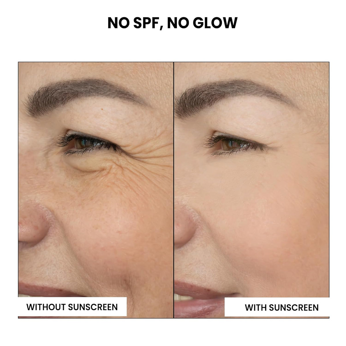 Before and after comparison of skin with and without sunscreen, emphasizing the importance of SPF.