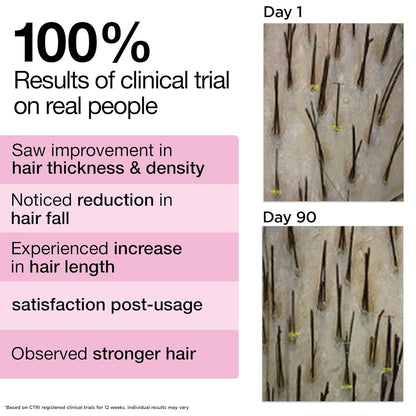 Soulflower Rosemary Hair Growth Oil, Hair Fall Control, Healthy Scalp, Strong Hair, Rosemary, Lavender, Castor|100% Pure, Natural, Organic, Clinically Proven for Hair Growth, 225ml