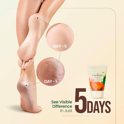 Moha Foot Cream for Dry & Cracked Feet | Deep Nourishment & Fast Healing Heel Repair Cream | Cooling & Vegan Formula with Aloe, Papaya, Peppermint & kapurkachri | Clinically Proven | Moisturizing Foot Cream for Rough Calloused Skin 100gm