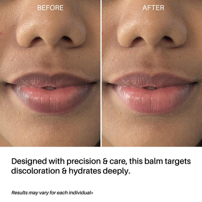 DERMDOC LipBright Treatment with 1% Glutathione + 2.5% Arbutin Lip Balm, 10 gm | Brightens Lip | Reduces Pigmentation | For Dry & Chapped Lips | Lightweight | Non - sticky