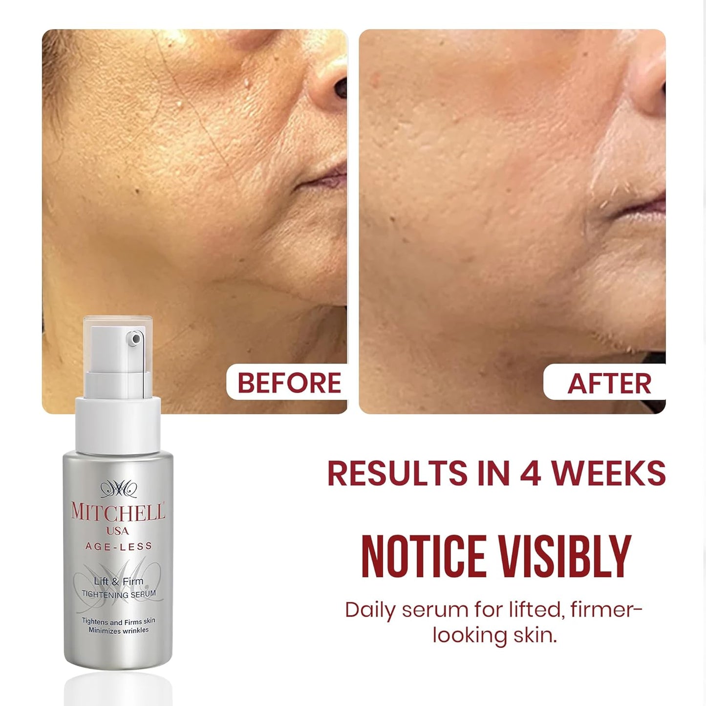 Mitchell USA Lift & Firm Instant Face Tightening and Anti Aging Serum | Targets wrinkles | Helps lift and tighten skin | With Lotus Seed Extract, Hazel Liquid Extract & Vitamin E | For all skin types | 30ml