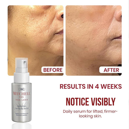 Mitchell USA Lift & Firm Instant Face Tightening and Anti Aging Serum | Targets wrinkles | Helps lift and tighten skin | With Lotus Seed Extract, Hazel Liquid Extract & Vitamin E | For all skin types | 30ml