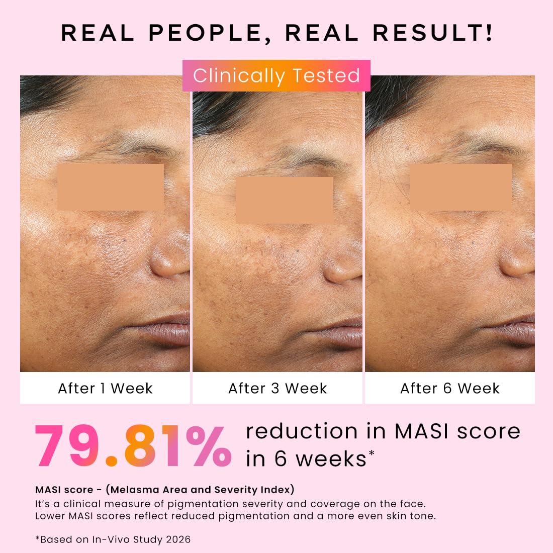 Before and after skin treatment results with clinical testing and MASI score reduction shown.