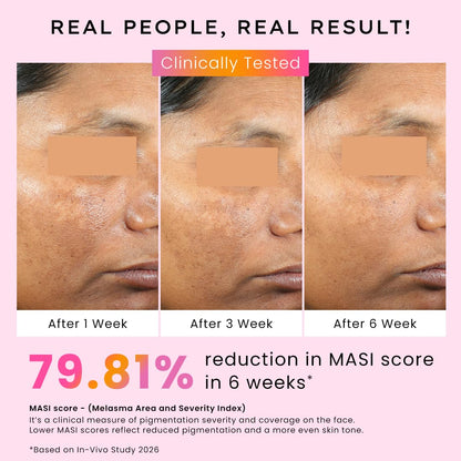 Before and after skin treatment results with clinical testing and MASI score reduction shown.