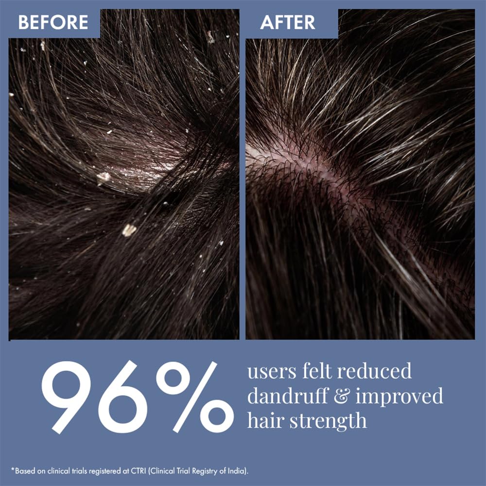 Before and after comparison of hair with dandruff reduction and improved hair strength, showing 96% user satisfaction.