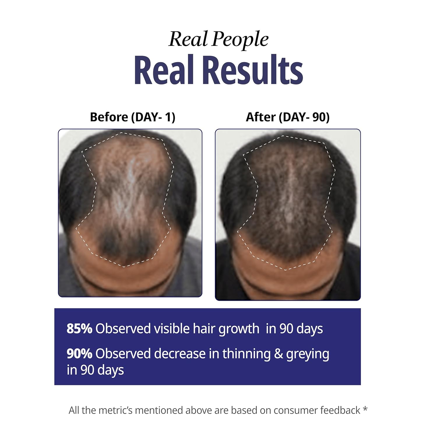 Before and after hair growth comparison with text on a white background