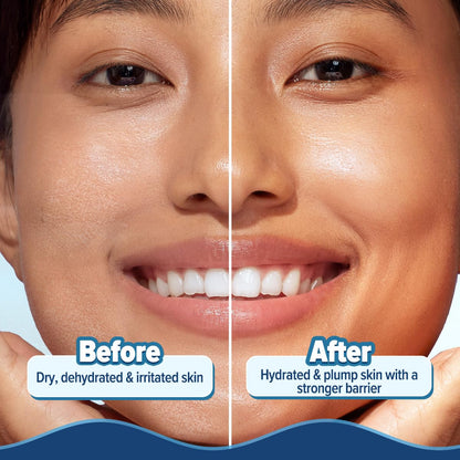 Aqualogica Barrier+ Hydra Gel Moisturizer with 5 Ceramides & Avocado | 24-Hour Intense Hydration | Weightless Water-Like Gel Texture | Non Sticky & Quick Absorbing for Healthy Skin Barrier | 200 g