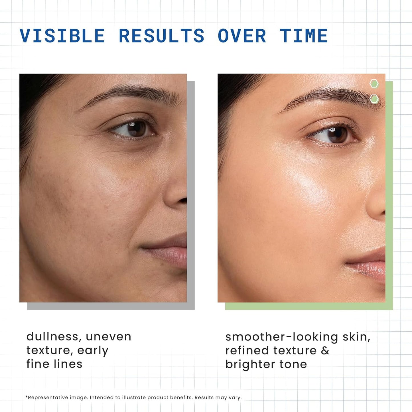 DERMDOC 2% Retinol Face Serum, 12ml | Reduces Fine Lines | Improves Skin Texture & Elasticity| Brightens Skin | Hydrating | Boosts Collagen | Smoother Complexion | For All Skin Types