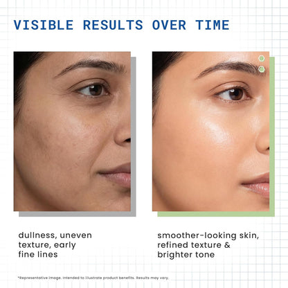 DERMDOC 2% Retinol Face Serum, 12ml | Reduces Fine Lines | Improves Skin Texture & Elasticity| Brightens Skin | Hydrating | Boosts Collagen | Smoother Complexion | For All Skin Types