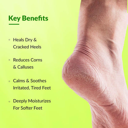 Fixderma Foobetik Cream, Foot cream, Foot care, For Dry & Cracked Feet, Moisturizes & Soothes Feet, Heel Repair, For Calloused, or Chapped Skin, Paraben Free 100gm