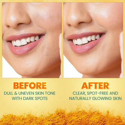 Before and after comparison of skin tone with dark spots on a yellow background