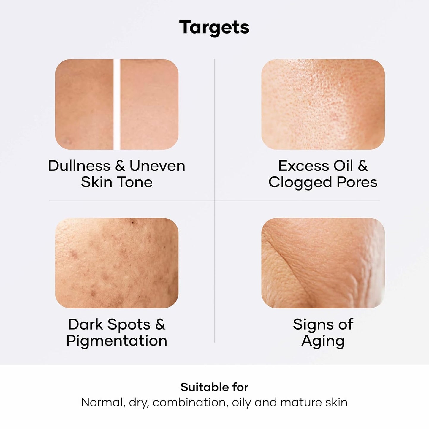 Cureskin Vitamin Boost D Tan Face Mask for Glowing Skin | D Tan Pack for Tan Removal | Fruit Based AHA Tan Removal De Tan Face Pack Mask for Women & Men | Tan Removal Cream