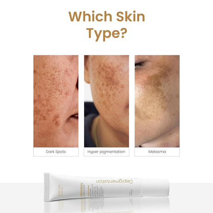 Personal Touch Melakey Radiance Cream for Hyperpigmentation & Melasma | Pigmentation Removal Cream | 5% Azelaic Acid | Dark Spot Corrector with Glycolic Acid & Niacinamide for Even Skin Tone | 20gm