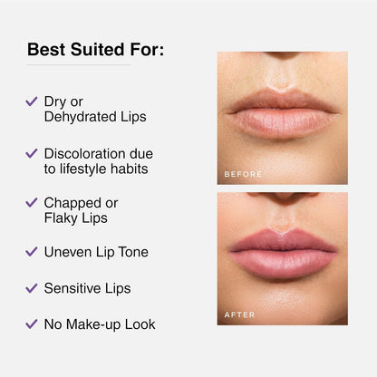 Cureskin Tinted Lip Balm For Women And Men |Hydrates & Protects For Lip Tint With Beetroot,Carrot & Strawberry |Lip Lightening Balm For Dark Lips |Tinted Lip Balm For Dark Lips To Lighten,1 Count