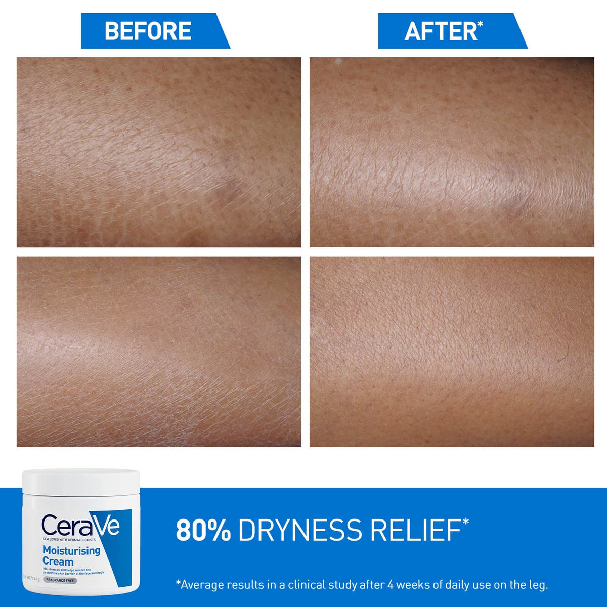 Before and after comparison of dry skin with CeraVe moisturizing cream shown.