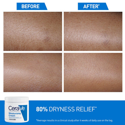 Before and after comparison of dry skin with CeraVe moisturizing cream shown.