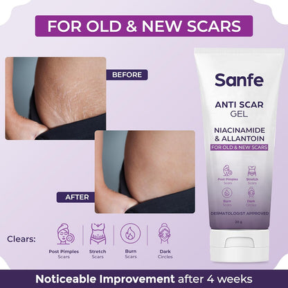 Sanfe Anti Scar Gel - Niacinamide & Allantoin | Acne/Stretch/Burn scars/Dark circles removal cream | For old & new scars-20 g
