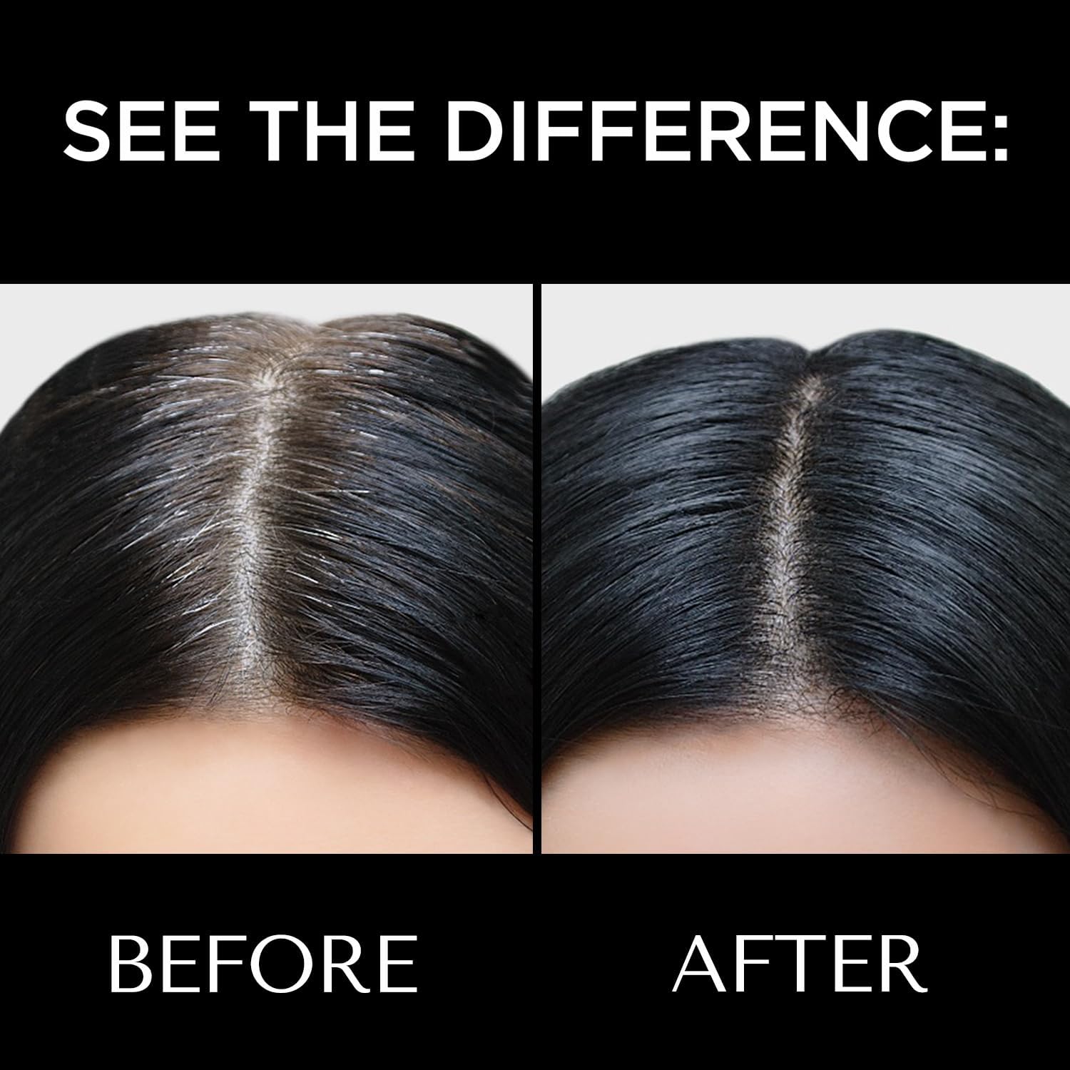 Before and after comparison of hair treatment on a person's scalp.