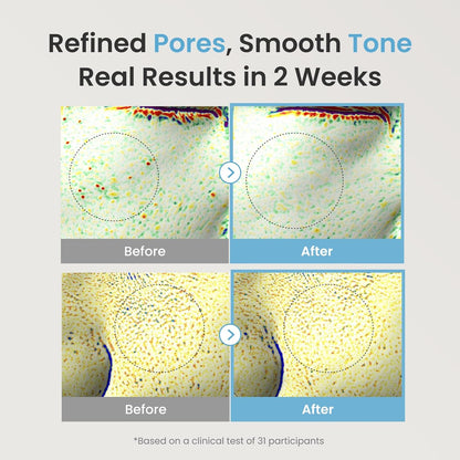 Before and after comparison of skin texture with text 'Refined Pores, Smooth Tone' and 'Real Results in 2 Weeks'.