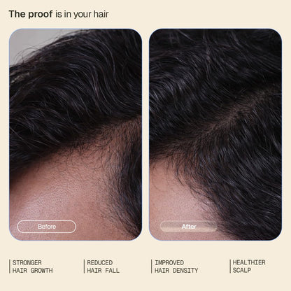 Arata Hair Growth Serum 3% Redensyl, 3% Procapil & 5% Kopexil Infused with Coffee, Onion & Rice Water | Boosts New Growth & Controls Hairfall | Hair Growth Serum for Scalp | Clinically Proven | Derma Tested | For Men & Women | 30ml