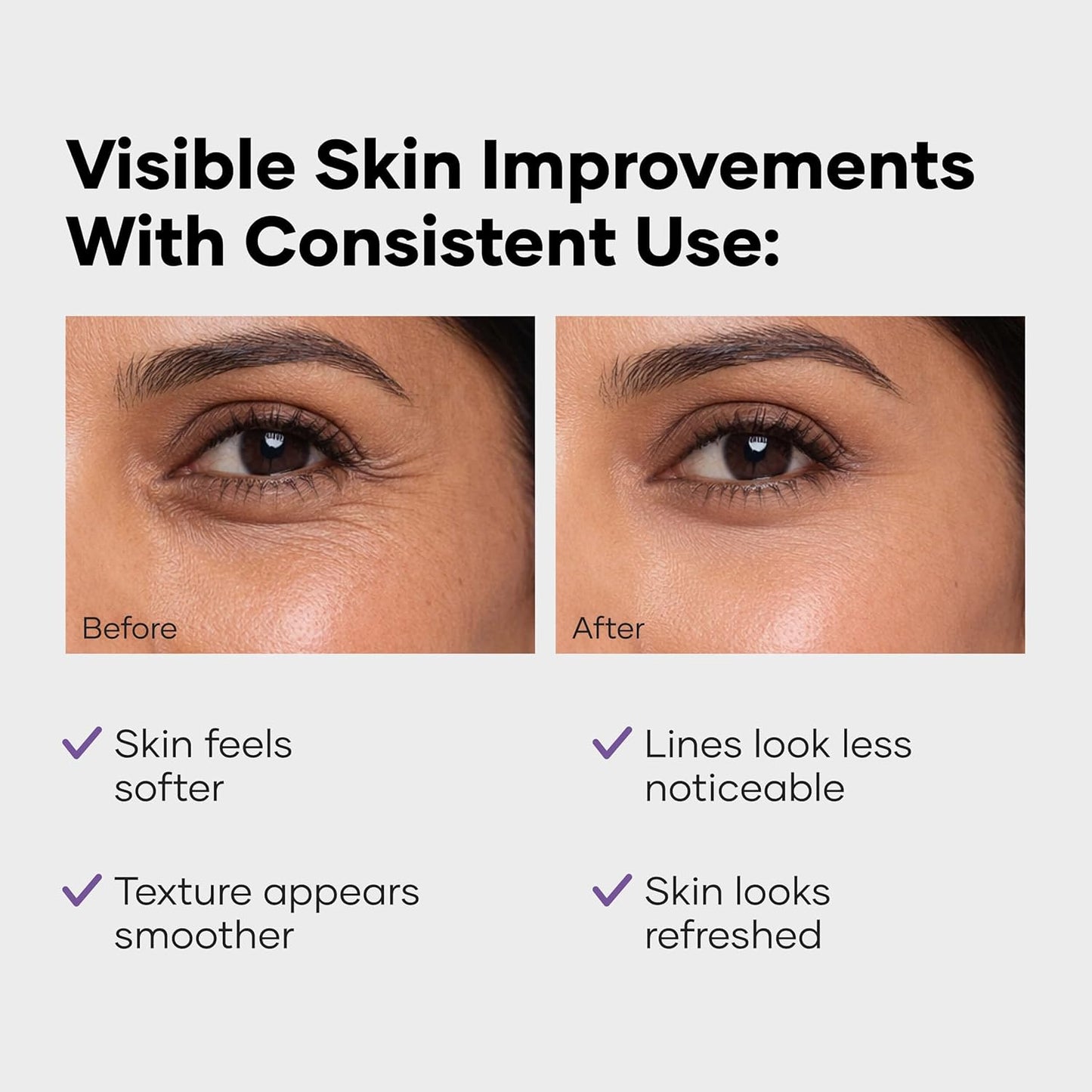 Cureskin Collagen Peptides for Women | Collagen Boost Hyaluronic Acid Serum | Plumps & Repairs with Hyaluronic Acid, Peptides and Probiotics