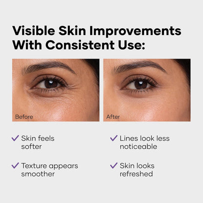 Cureskin Collagen Peptides for Women | Collagen Boost Hyaluronic Acid Serum | Plumps & Repairs with Hyaluronic Acid, Peptides and Probiotics