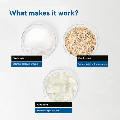 Be Bodywise Anti Dandruff Shampoo 150ml | pH 5.5 | Clinically Proven Actives with Citric Acid, Oat & Aloe Vera Extract | Paraben Free & Vegan