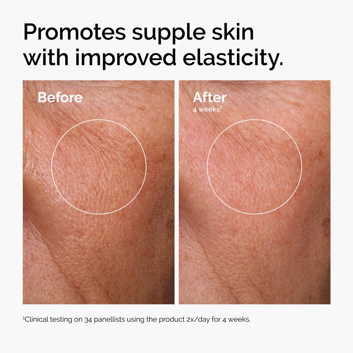 Before and after comparison of skin texture with text promoting suppleness and elasticity.