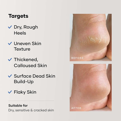 Cureskin Foot Care Cream for Cracked Heels | Repairs, Softens, and Exfoliates | Foot Cream for Women and Men, 50 g (Pack of 1)