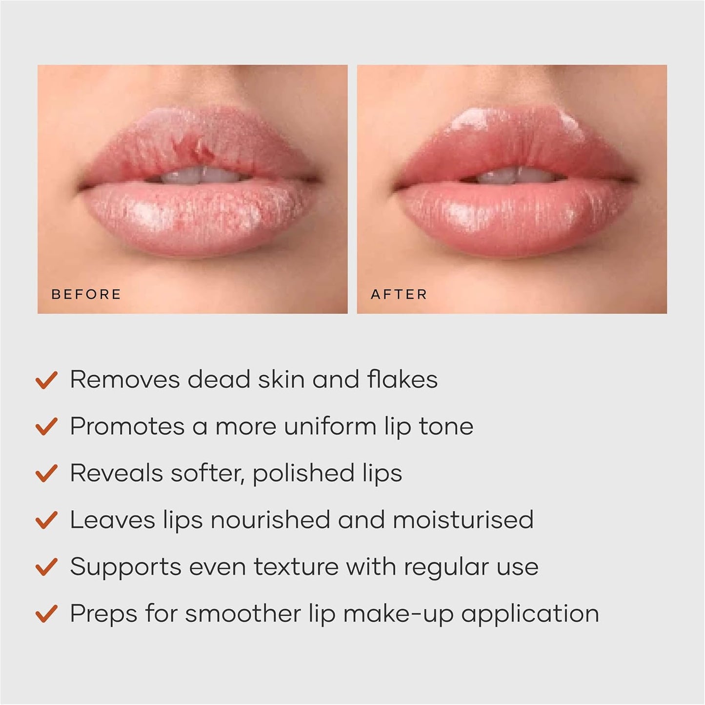 Cureskin Lightening Lip Scrub for Men and Women | Lip Scrub for Dark Lips to Lighten Pink with Hyaluronic Acid, Shea Butter and Walnut Shell Powder, 10 g (Pack of 1)