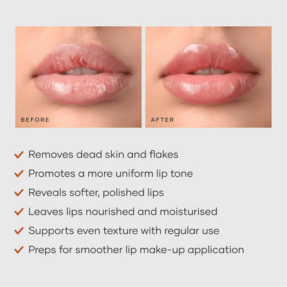 Cureskin Lightening Lip Scrub for Men and Women | Lip Scrub for Dark Lips to Lighten Pink with Hyaluronic Acid, Shea Butter and Walnut Shell Powder, 10 g (Pack of 1)
