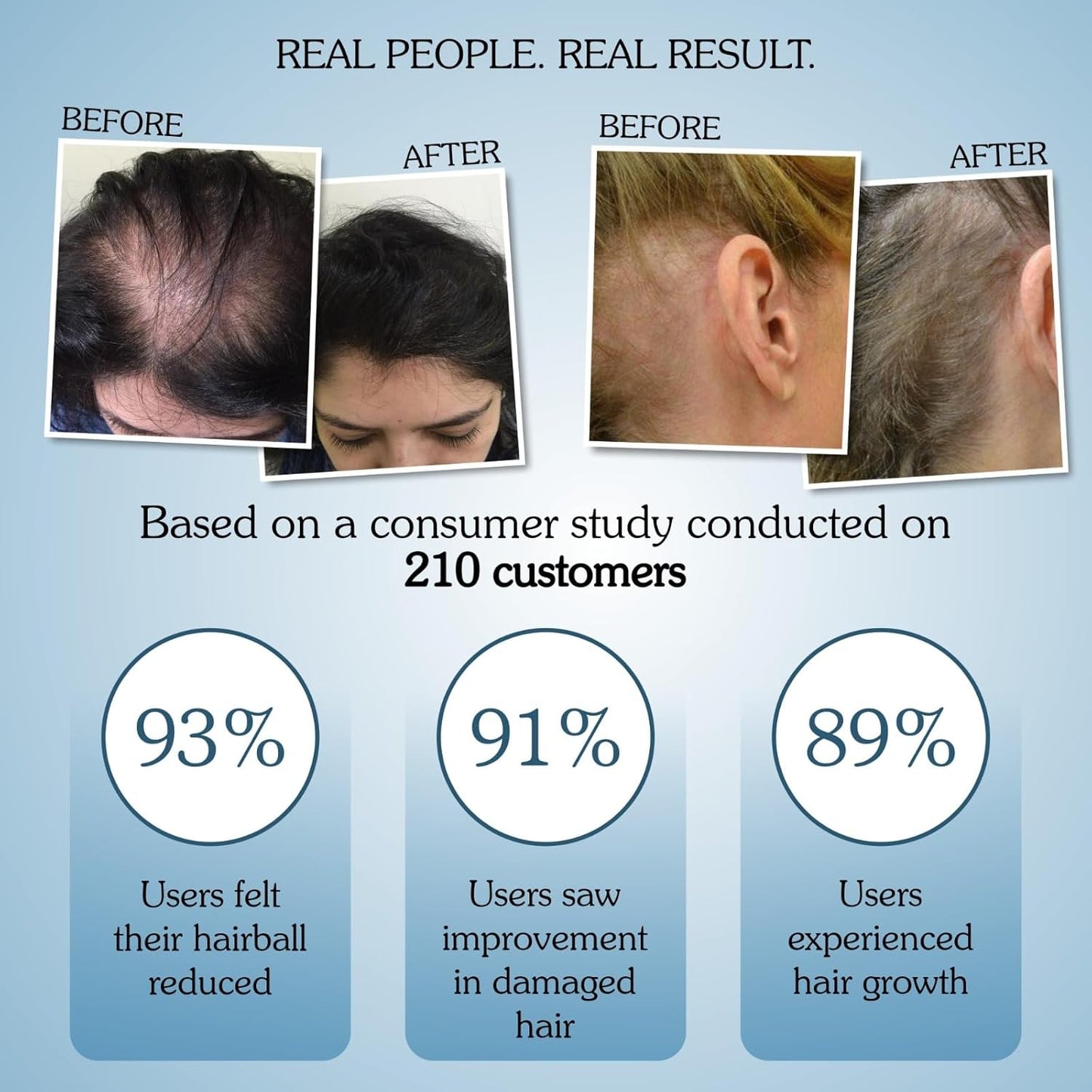 BAKE Rosemary Water Hair Growth Spray with Multi Peptides for Hair Fall Control & Hair Growth | 4% Anagain, 2% Baicapil, Plant Keratin | For Keratin Treated & Damaged Hair | 100ml