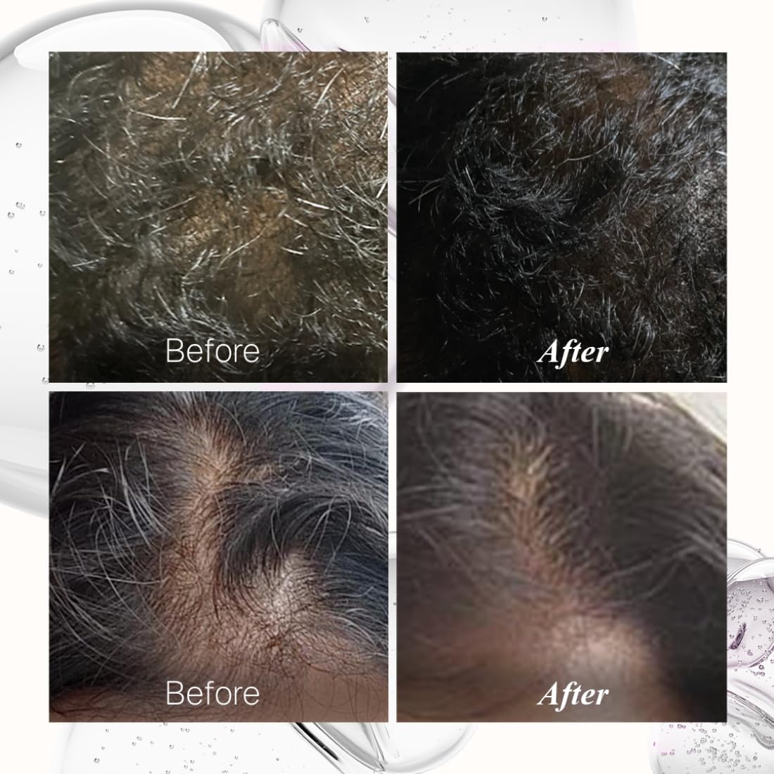 Before and after comparison of hair treatment on a person's head.