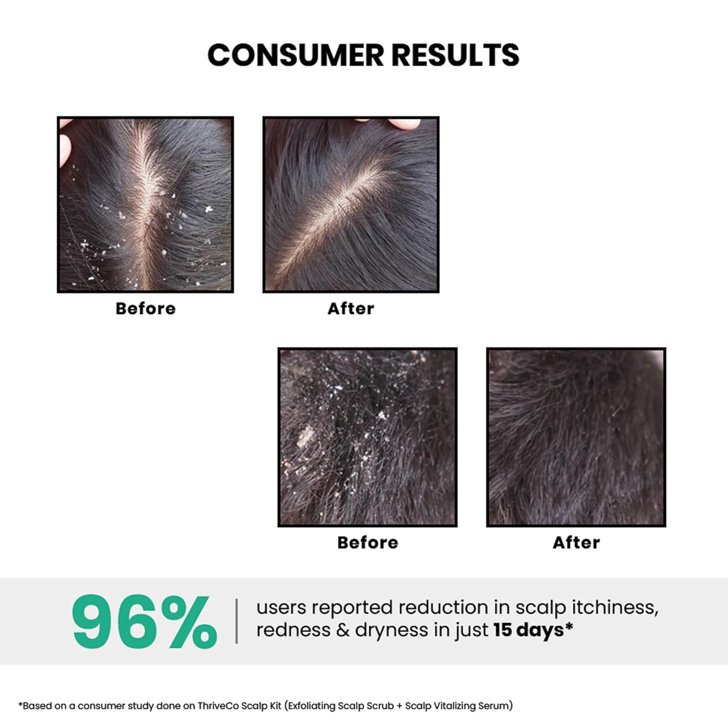 Before and after images of scalp conditions with text highlighting user results.