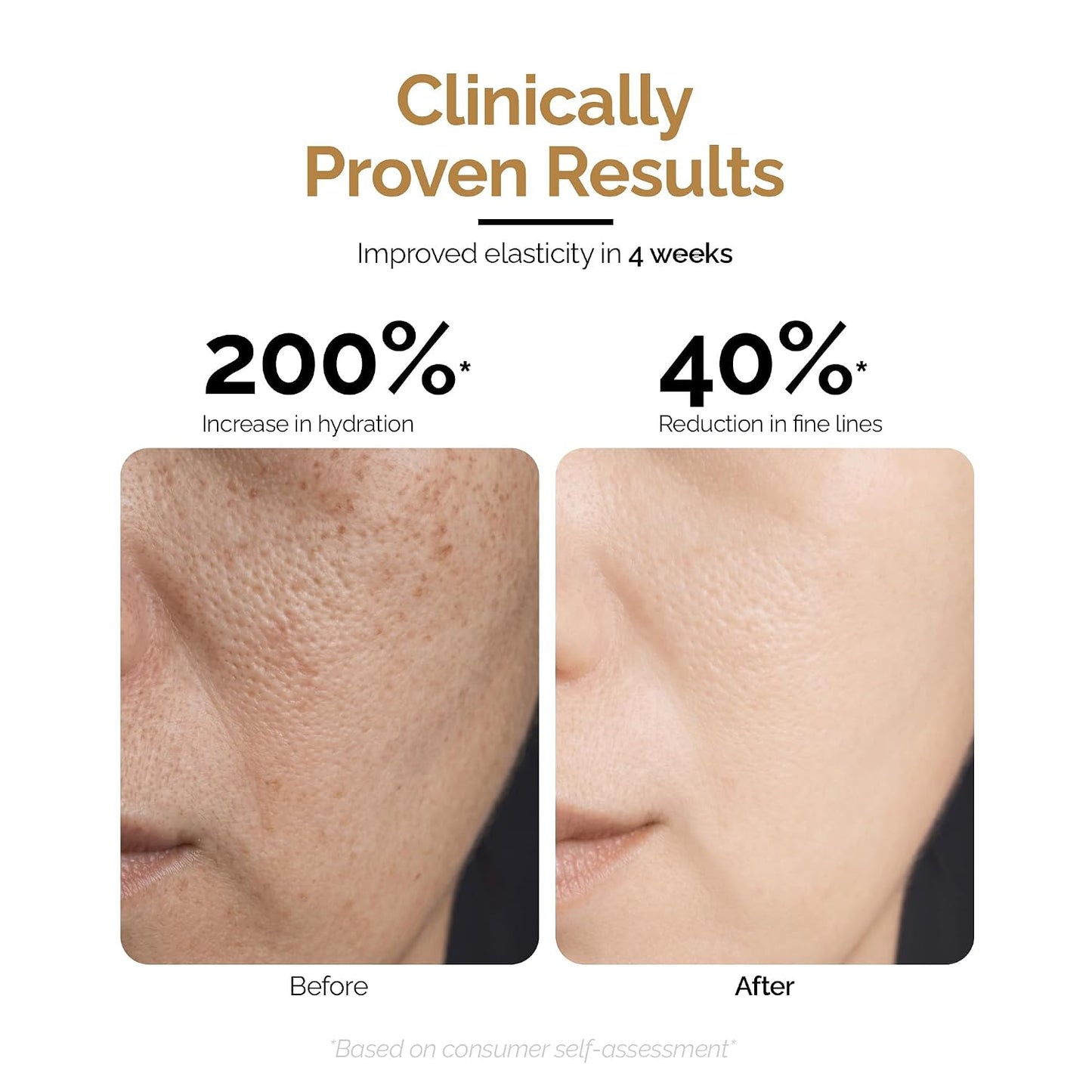 Personal Touch Mucin Moist Serum Cruelty Free - World’s 1st Snail Mucin With 9 Types of Hyaluronic Acid, Ceramides, Niacinamide | Korean Skincare | Dryness, Fine Lines, Skin Barrier Repair | 30ml
