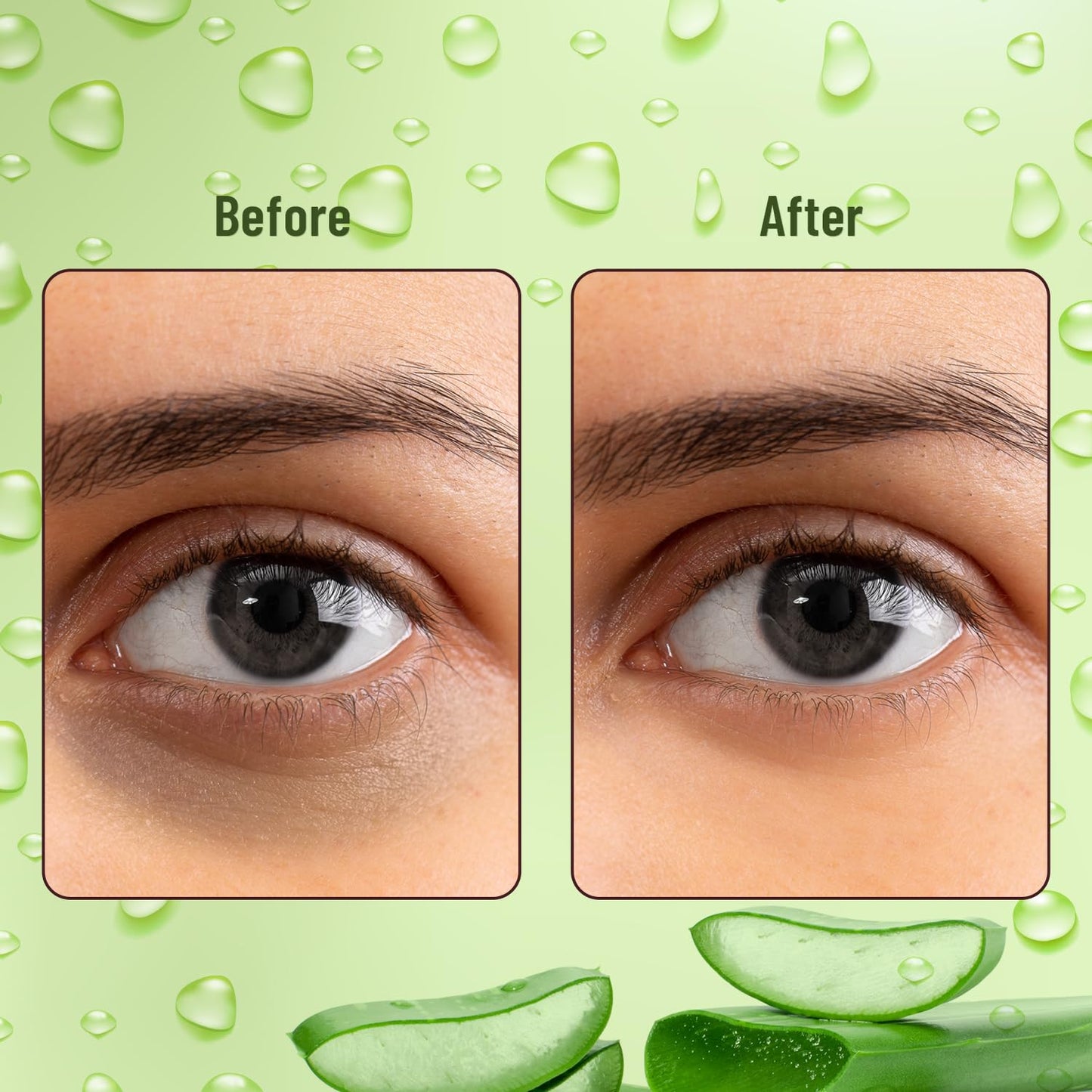 Swiss Beauty Hydra Anti Wrinkle Eye Serum Patch| Treats Dark Circles, Fine Lines And Wrinkles | Enriched With Collagen And Aloe Vera Extract | Shade- 01 Aloevera, 60 Pcs