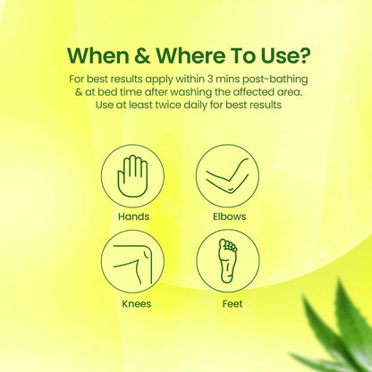 NMFe  150 gm For Intense Moisturisation with Urea 7% & Aloe vera for thick and dry skin | Truly the Healing Moisturiser | For very dry skin | Takes care of cracked heels & Fissure feet effectively