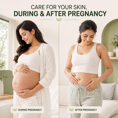 Pregnacream Stretch Mark Cream for Pregnancy & Post Pregnancy, 100g